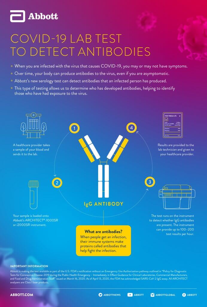 Covid-19 Lab test to detect antibodies