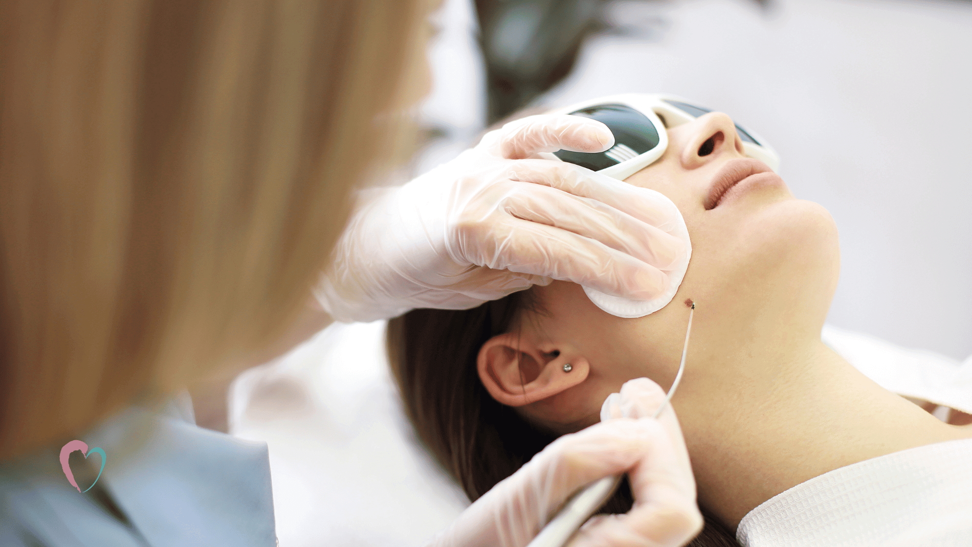 mole removed from face